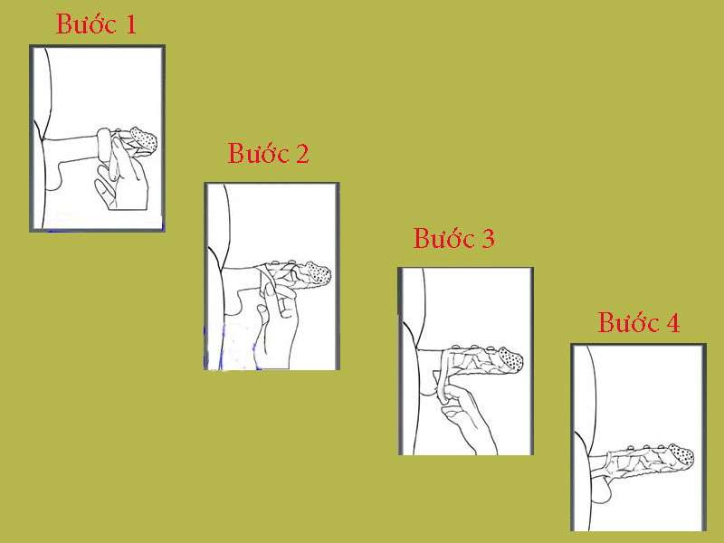 Hướng dẫn sử dụng bao cao su đôn dên
